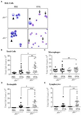 Differential Regulation of the Asthmatic Phenotype by the Aryl Hydrocarbon Receptor